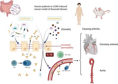 Findings on the Relationship Between Intestinal Microbiome and Vasculitis